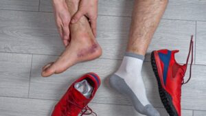 Az Achilles sérülések hosszú időre megakadályozhatnak bennünket a sportolásban, hobbink gyakorlásában, vagy a munkában, így érdemes megelőzni a kialakulását.